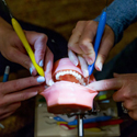 model of a mouth receiving dental treatment